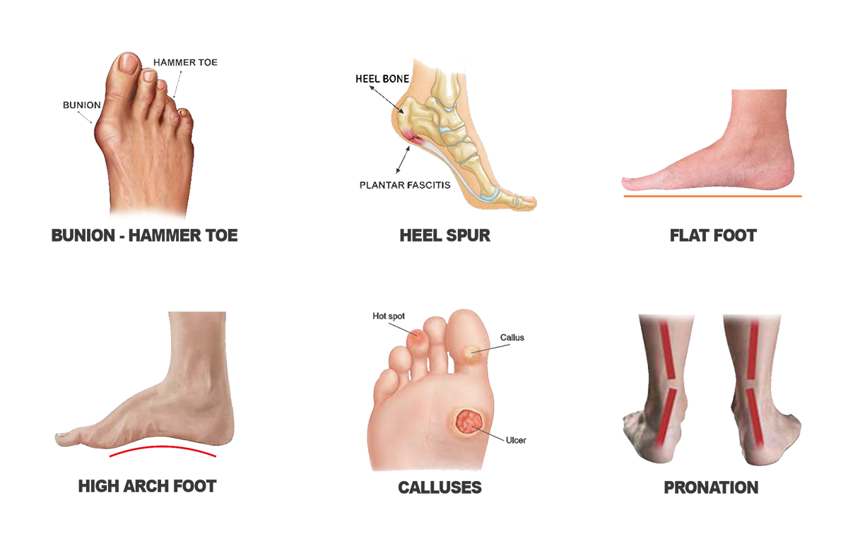 Masalah Kaki HP Masalah Kaki HP