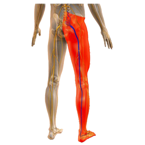Masalah Kaki - Sciatic nerve copy Masalah Kaki - Sciatic nerve copy